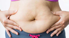 Gastric Sleeve Surgery - The Definitive Guide