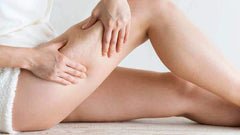 Can You Ever Really Get Rid of Cellulite?